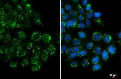 Immunocytochemistry/ Immunofluorescence Polypeptide GalNac Transferase 3/GALNT3 Antibody