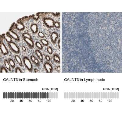 Immunohistochemistry-Paraffin Polypeptide GalNac Transferase 3/GALNT3 Antibody