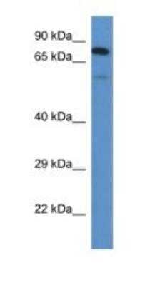 Western Blot: Polypeptide GalNac Transferase 3/GALNT3 Antibody [NBP1-74244] - Titration: 1.0 ug/ml Positive Control: Rat Brain.