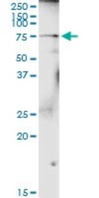 Western Blot: Polypeptide GalNac Transferase 4/GALNT4 Antibody [H00008693-D01P] - Analysis of GALNT4 expression in mouse brain.