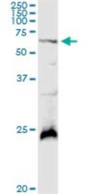 Western Blot: Polypeptide GalNac Transferase 4/GALNT4 Antibody [H00008693-D01P] - Analysis of GALNT4 expression in rat brain.
