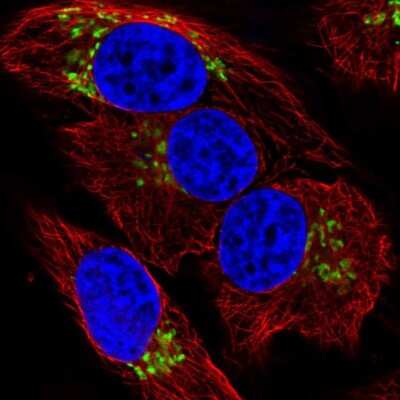 Immunocytochemistry/Immunofluorescence: Polypeptide GalNac Transferase 7/GALNT7 Antibody [NBP2-39054] - Staining of human cell line HeLa shows localization to the Golgi apparatus. Antibody staining is shown in green.
