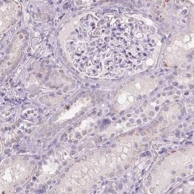 Immunohistochemistry-Paraffin Polypeptide GalNac Transferase 7/GALNT7 Antibody