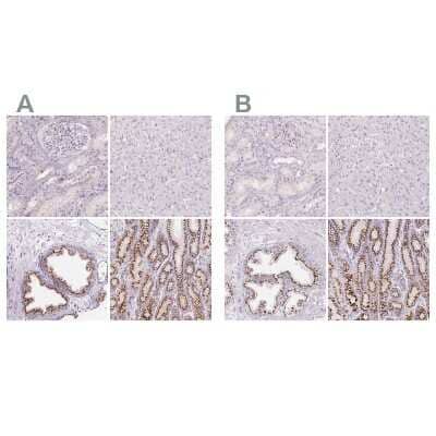 Immunohistochemistry-Paraffin Polypeptide GalNac Transferase 7/GALNT7 Antibody