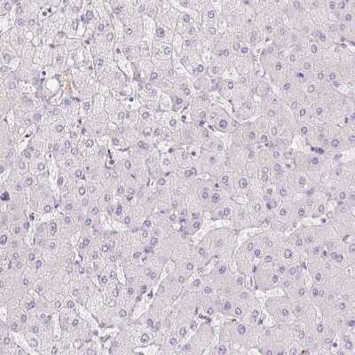 Immunohistochemistry-Paraffin Polypeptide GalNac Transferase 7/GALNT7 Antibody