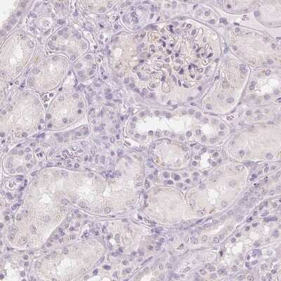 Immunohistochemistry-Paraffin: Polypeptide GalNac Transferase 7/GALNT7 Antibody [NBP2-39054] - Staining of human kidney shows no positivity in cells in tubules as expected.