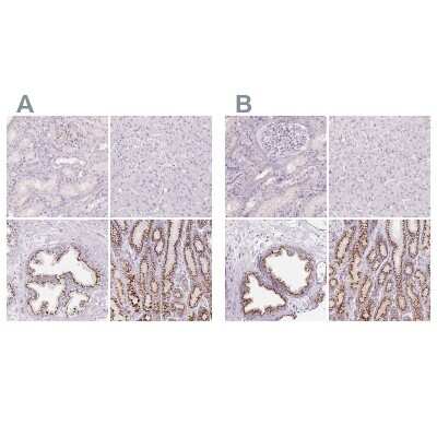 <b>Independent Antibodies Validation and Orthogonal Strategies Validation.</b>Immunohistochemistry-Paraffin: Polypeptide GalNac Transferase 7/GALNT7 Antibody [NBP2-39054] - Staining of human kidney, liver, prostate and stomach using Anti-GALNT7 antibody NBP2-39054 (A) shows similar protein distribution across tissues to independent antibody NBP2-39021 (B).