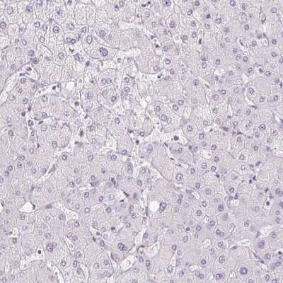 Immunohistochemistry-Paraffin: Polypeptide GalNac Transferase 7/GALNT7 Antibody [NBP2-39054] - Staining of human liver shows no positivity in hepatocytes as expected.