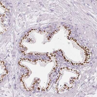 Immunohistochemistry-Paraffin: Polypeptide GalNac Transferase 7/GALNT7 Antibody [NBP2-39054] - Staining of human prostate shows strong positivity in glandular cells of Golgi apparatus.