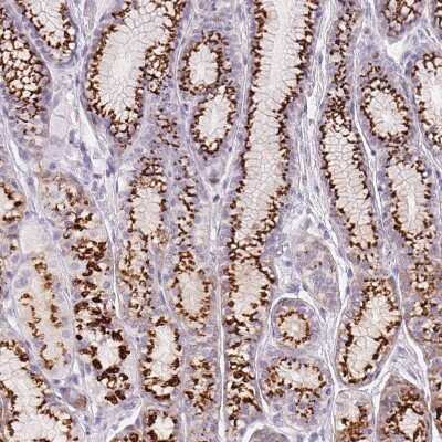 Immunohistochemistry-Paraffin: Polypeptide GalNac Transferase 7/GALNT7 Antibody [NBP2-39054] - Staining of human stomach shows strong positivity in Golgi apparatus in glandular cells.