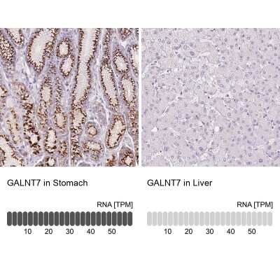 Immunohistochemistry-Paraffin Polypeptide GalNac Transferase 7/GALNT7 Antibody - BSA Free