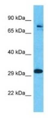 Western Blot: Polypeptide GalNac Transferase 7/GALNT7 Antibody [NBP3-09941] - Western blot analysis of Polypeptide GalNac Transferase 7/GALNT7 in Jurkat Whole Cell lysates. Antibody dilution at 1.0ug/ml