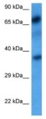 Western Blot: Polypeptide GalNac Transferase 7/GALNT7 Antibody [NBP3-10009] - Western blot analysis of Polypeptide GalNac Transferase 7/GALNT7 in Breast Tumor lysates. Antibody dilution at 1ug/ml