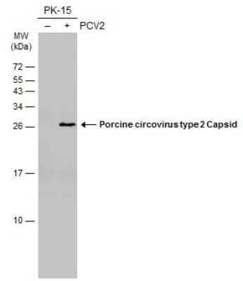 Western Blot: Porcine Circovirus 2 Capsid Antibody (GT972) [NBP3-13604] - Non-infected (-) and infected (+) PK-15 whole cell extracts (15 ug) were separated by 15% SDS-PAGE, and the membrane was blotted with Porcine circovirus type 2 Capsid antibody [GT972] (NBP3-13604) diluted at 1:1000. The HRP-conjugated anti-mouse IgG antibody (NBP2-19382) was used to detect the primary antibody.
