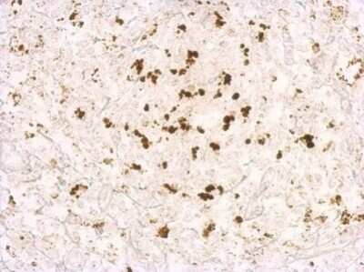 Immunohistochemistry-Paraffin Porcine Circovirus 2 Capsid Antibody