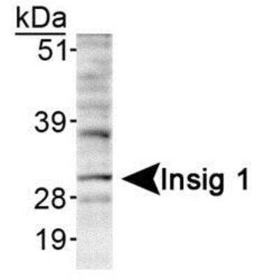Western Blot: Postmenopausal Obesity and Metabolism Antibody Pack 2vials [NBP1-78953] - Detection of Insig 1 in HepG2 lyaste using NB110-55244.