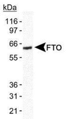 Western Blot: Postmenopausal Obesity and Metabolism Antibody Pack 2vials [NBP1-78953] - Detection of FTO in human brain lysate using anti-FTO NB110-60935.