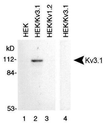 Western Blot: Potassium Channel Kv3.1 Antibody [NBP1-42819] -  Membrane preparations from HEK-293 cells untransfected (lane 1), transfected with Kv3.1 (lanes 2 and 4) and transfected with Kv1.2 (lane 3) were subjected to SDS-PAGE and were Western blotted with Kv3.1 Antibody (NBP1-42819). Lane 4 was probed with NBP1-42819 that had been preincubated with the peptide used to generate NBP1-42819.
