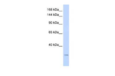 Western Blot: Potassium channel subfamily K member 6 Antibody [NBP2-83408] - WB Suggested Anti-KCNK6 Antibody Titration: 0.2-1 ug/ml. ELISA Titer: 1:1562500. Positive Control: Hela cell lysate