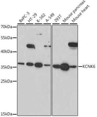 Western Blot: Potassium channel subfamily K member 6 Antibody [NBP2-93795] - Analysis of extracts of various cell lines, using Potassium channel subfamily K member 6 at 1:1000 dilution.Secondary antibody: HRP Goat Anti-Rabbit IgG (H+L) at 1:10000 dilution.Lysates/proteins: 25ug per lane.Blocking buffer: 3% nonfat dry milk in TBST.Detection: ECL Basic Kit .Exposure time: 90s.
