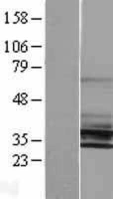 Western Blot: Potassium channel subfamily K member 6 Overexpression Lysate (Adult Normal) [NBL1-12187] Left-Empty vector transfected control cell lysate (HEK293 cell lysate); Right -Over-expression Lysate for Potassium channel subfamily K member 6.