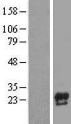 Western Blot: Precerebellin Overexpression Lysate (Adult Normal) [NBL1-08739] Left-Empty vector transfected control cell lysate (HEK293 cell lysate); Right -Over-expression Lysate for Precerebellin.