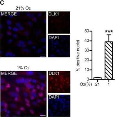 Immunocytochemistry/Immunofluorescence: Pref-1/DLK1/FA1 Antibody [NBP2-33697] - Representative images and relative quantifications of immunofluorescent stainings showing DLK1 localization in U3082MG cells grown at 21% or 1% O2 for 48 h. In the whole figure significance is represented as *p < 0.05, **p < 0.01, and ***p < 0.001 vs. respective 21% O2 controls. Image collected and cropped by CiteAb from the following publication (//pubmed.ncbi.nlm.nih.gov/32205867/) licensed under a CC-BY license.