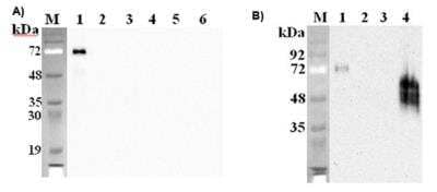 Western Blot: Pref-1/DLK1/FA1 Antibody (PF105B) [NBP2-80044] - Western blot analysis using anti-DLK1 (mouse), mAb (PF105B) at 1:2'000 dilution.Panel A)1: Mouse DLK1 Fc-protein.2: Human DLK1 Fc-protein.3: Mouse DLL1 Fc-protein.4: Mouse DLL4 Fc protein.5: Mouse Jagged-1 Fc-protein.6: Unrelated Fc-protein (negative control).Panel B)1: Mouse DLK1 Fc-protein.2: Mouse DLL1 Fc-protein.3: Human DLK1 (ED) (FLAG(R)-tagged).4: 3T3L1 cell lysate.