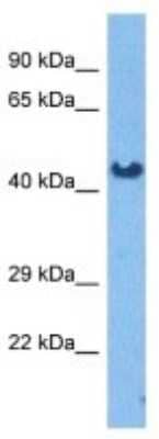 Western Blot Pregnancy Specific beta-1-glycoprotein 7 Antibody