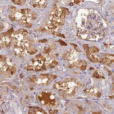 Immunohistochemistry-Paraffin: Pregnancy Zone Protein Antibody [NBP1-85489] - Staining of human kidney shows distinct cytoplasmic and extracellular positivity in renal tubules.