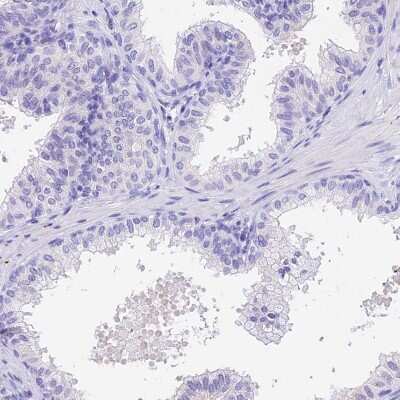 Immunohistochemistry-Paraffin Pregnancy specific beta 1 glycoprotein 11 Antibody - BSA Free