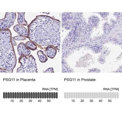 Immunohistochemistry-Paraffin Pregnancy specific beta 1 glycoprotein 11 Antibody - BSA Free