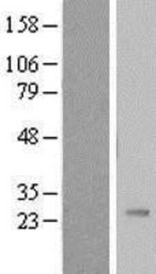 Western Blot: Pregnancy specific beta 1 glycoprotein 11 Overexpression Lysate (Adult Normal) [NBL1-14864] Left-Empty vector transfected control cell lysate (HEK293 cell lysate); Right -Over-expression Lysate for Pregnancy specific beta 1 glycoprotein 11.