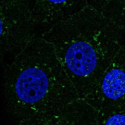 Immunocytochemistry/Immunofluorescence: Presenilin-1 Antibody [NBP2-57002] - Staining of human cell line MCF7 shows localization to the Golgi apparatus & cell junctions.