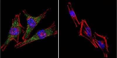 Immunocytochemistry/Immunofluorescence: Presenilin-2 Antibody (APS 21) [NB100-74512] - Presenilin 2 staining (green), F-Actin staining with Phalloidin (red) and nuclei with DAPI (blue) is shown. Cells were grown on chamber slides and fixed with formaldehyde prior to staining. Cells were probed without (control) or with or an antibody recognizing Presenilin- 2 at a dilution of 1:100 over night at 4C, washed with PBS and incubated with a DyLight-488 conjugated.