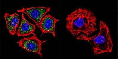 Immunocytochemistry/Immunofluorescence: Presenilin-2 Antibody (APS 21) [NB100-74512] - Presenilin 2 staining (green), F-Actin staining with Phalloidin (red) and nuclei with DAPI (blue) is shown. Cells were grown on chamber slides and fixed with formaldehyde prior to staining. Cells were probed without (control) or with or an antibody recognizing Presenilin- 2 at a dilution of 1:100 over night at 4C, washed with PBS and incubated with a DyLight-488 conjugated.