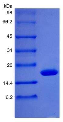 SDS-Page: Primate G-CSF Protein [NBP2-35297]