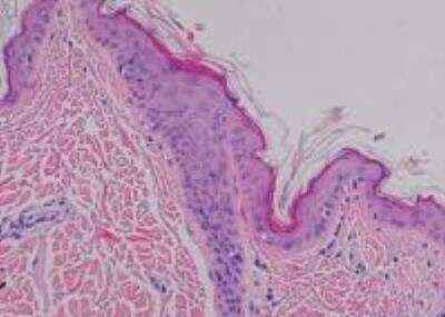 Hematoxylin & Eosin Stain: Primate Organs Tissue MicroArray (Normal) [NBP2-30186] -  01. Skin, Abdominal