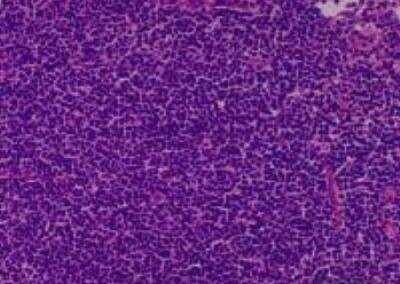 Hematoxylin & Eosin Stain: Primate Organs Tissue MicroArray (Normal) [NBP2-30186] -  04. Lymph node