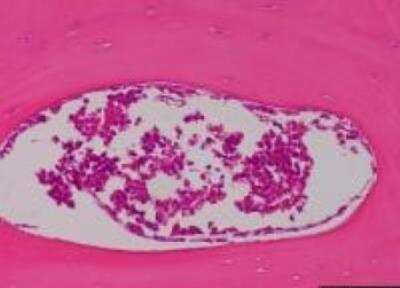 Hematoxylin & Eosin Stain: Primate Organs Tissue MicroArray (Normal) [NBP2-30186] - 05. Bone, Skull