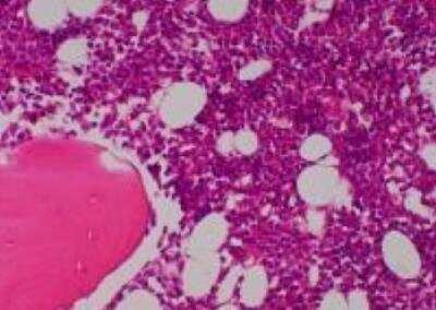 Hematoxylin & Eosin Stain: Primate Organs Tissue MicroArray (Normal) [NBP2-30186] -  07.Bone, sternum