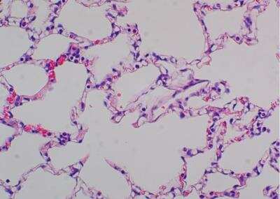 Hematoxylin & Eosin Stain: Primate Organs Tissue MicroArray (Normal) [NBP2-30186] -  13. Lung.