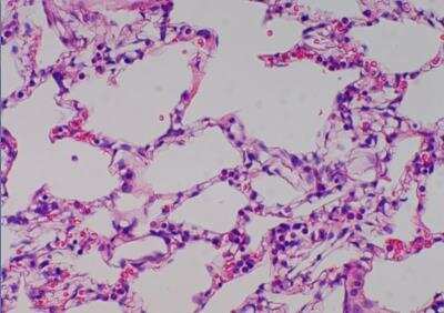 Hematoxylin & Eosin Stain: Primate Organs Tissue MicroArray (Normal) [NBP2-30186] - 14. Lung