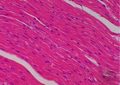 Hematoxylin & Eosin Stain: Primate Organs Tissue MicroArray (Normal) [NBP2-30186] -  15. Artrium