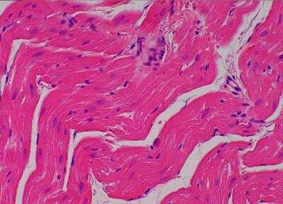 Hematoxylin & Eosin Stain: Primate Organs Tissue MicroArray (Normal) [NBP2-30186] -  16. Right ventricle