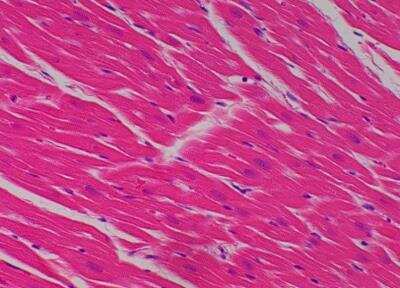 Hematoxylin & Eosin Stain: Primate Organs Tissue MicroArray (Normal) [NBP2-30186] -  17. Left ventricle