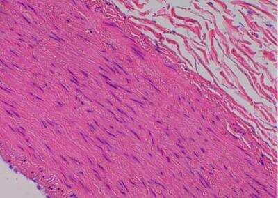 Hematoxylin & Eosin Stain: Primate Organs Tissue MicroArray (Normal) [NBP2-30186] -  18. Aorta, abdominal.