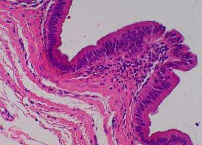 Hematoxylin & Eosin Stain: Primate Organs Tissue MicroArray (Normal) [NBP2-30186] - 23. Gallbladder.