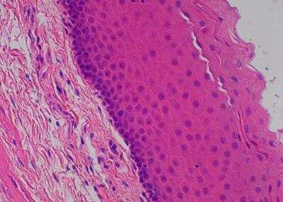 Hematoxylin & Eosin Stain: Primate Organs Tissue MicroArray (Normal) [NBP2-30186] - 26. Esophagus.