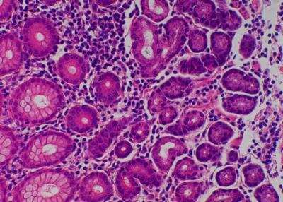 Hematoxylin & Eosin Stain: Primate Organs Tissue MicroArray (Normal) [NBP2-30186] -  27. Stomach, antral.